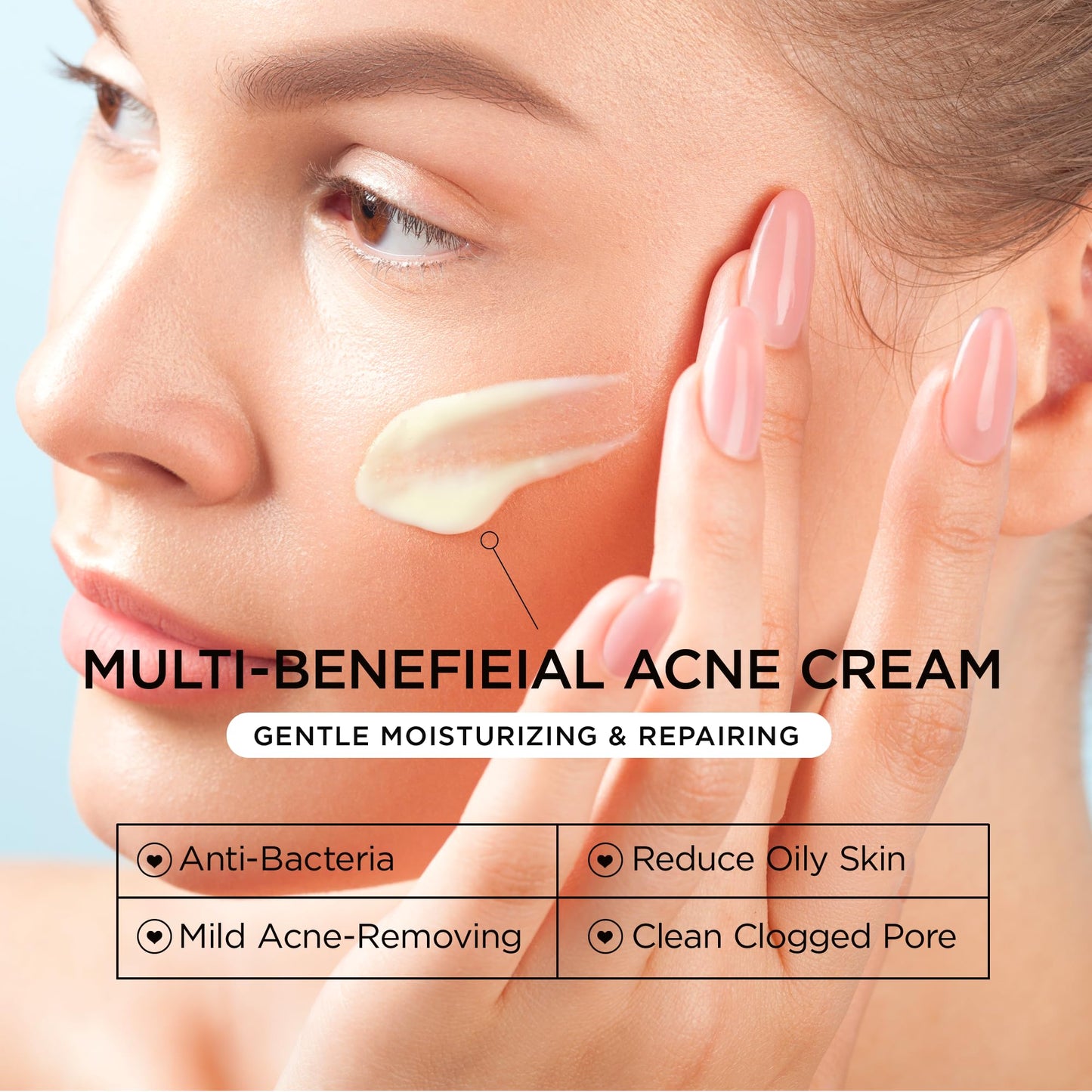 Acne Treatment for Face: Cystic Acne Spot Control Cream with Salicylic Acid & Tea Tree Oil for Blemishes - Gentle Hormonal & Pimple Treatment for Teens & Adults - 120 Day Supply & 3.38oz