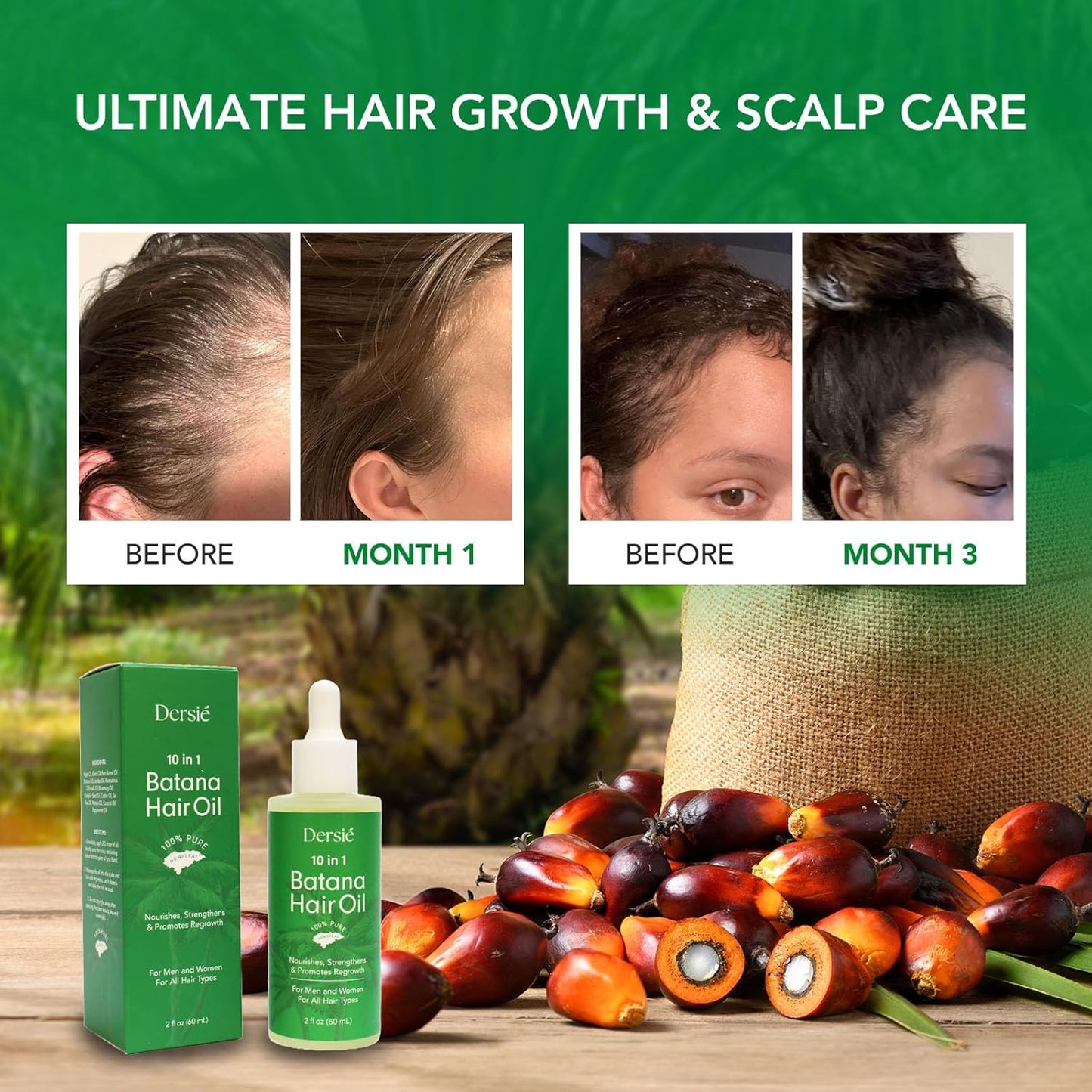 Hair Growth Oil - 10-in-1 Veganic Treatment with Batana & Rosemary for Thinning Hair - 2 fl oz