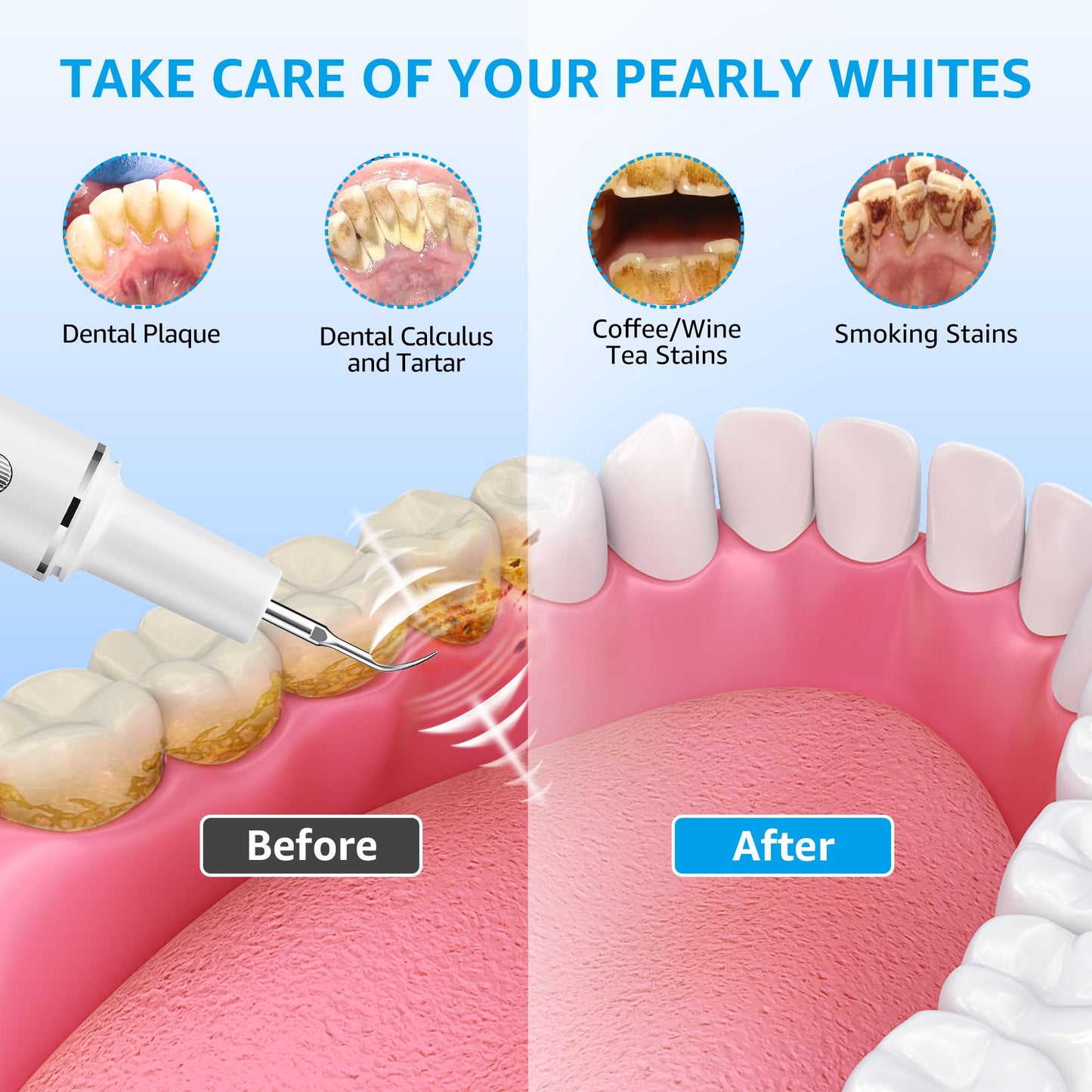 Teeth Cleaning Kit Plaque Remover for Teeth, Portable Dental Plaque Remover Tool with LED, Plaque Blaster for Human Teeth with 3 Modes, Tooth Scraper Plaque Tartar Remover for Teeth with Dental Tools