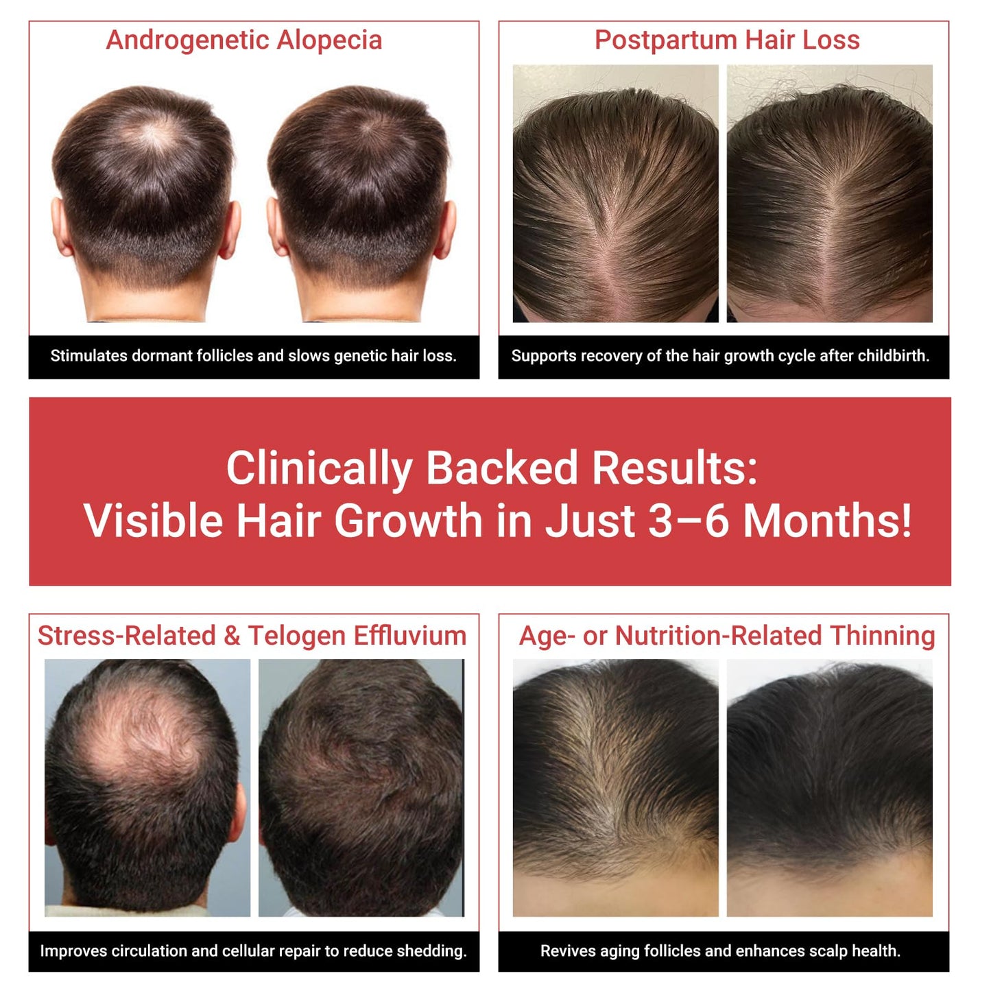 Laser Hair Growth Cap