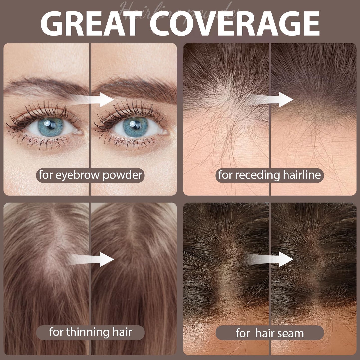2 Pack Hairline Powder for Women and Men, Used to Root Touch Up Hair Color, Thinning and Gray Hair Coverage and Bald Spots Coverage, Medium Brown