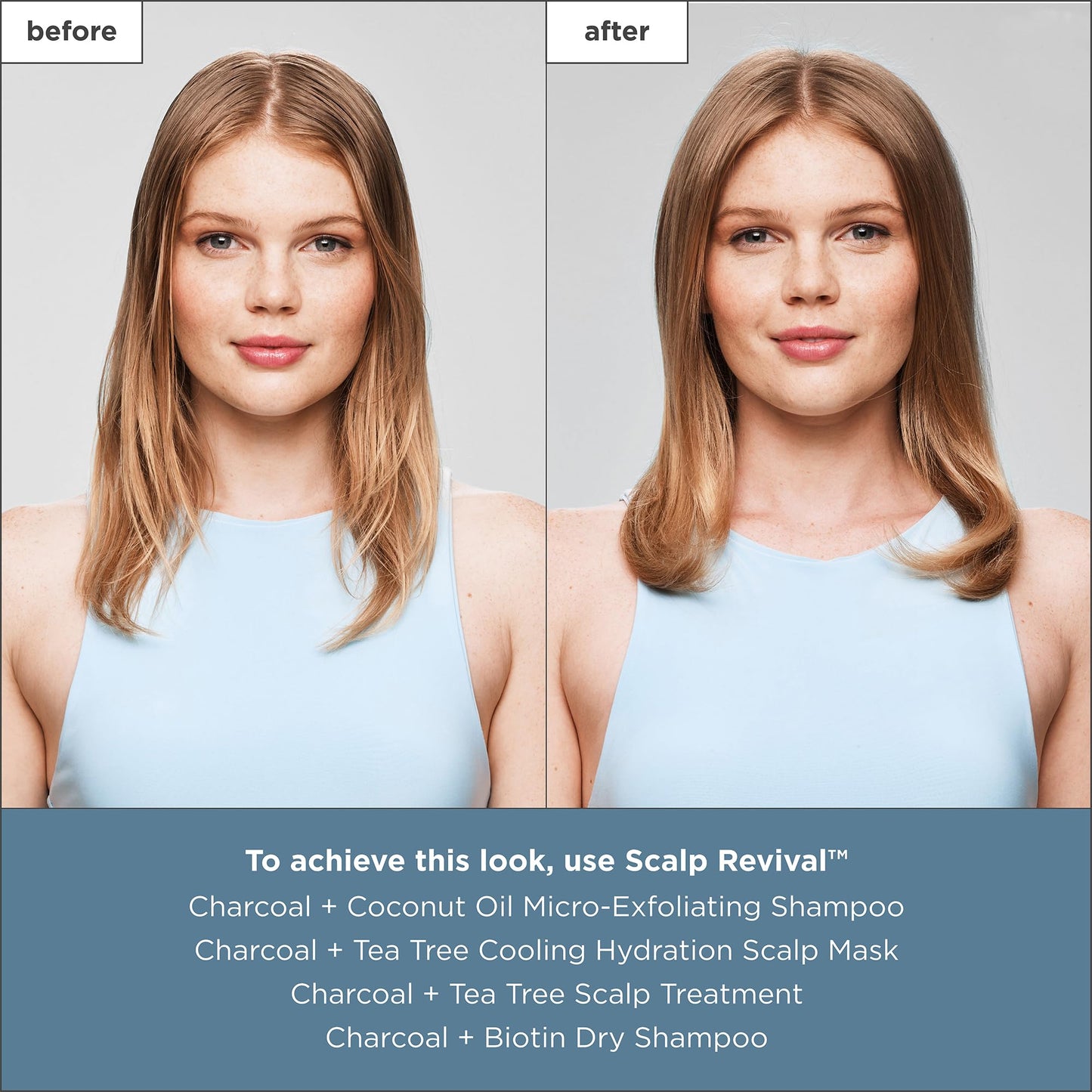 Briogeo Scalp Revival Charcoal + Tea Tree Cooling Hydration Scalp Mask, Dry Scalp Treatment and Moisturizer, Soothes a Dry, Flaky, Itchy Scalp, Treatment for Oily Scalp, Vegan, Cruelty-Free, 6 fl oz