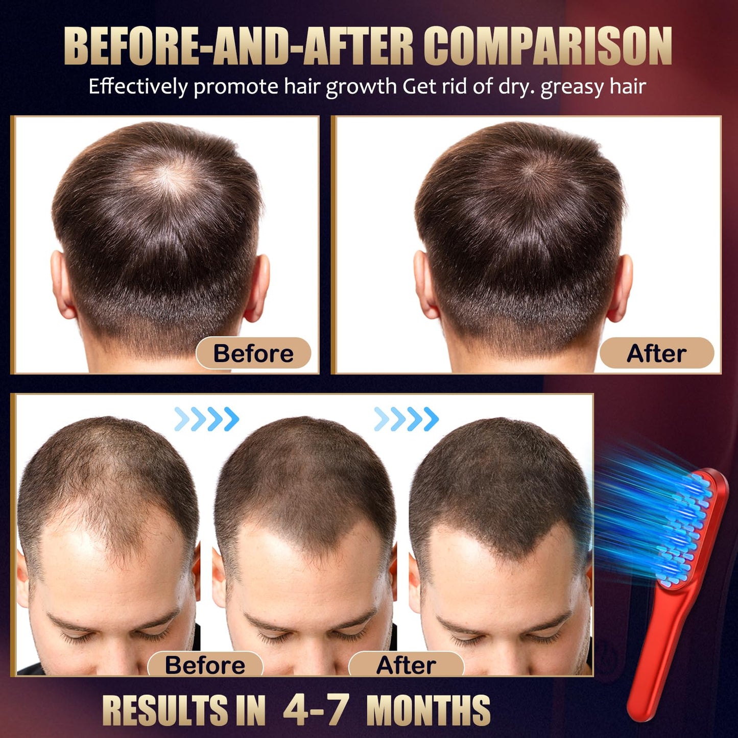 Laser Hair Growth Comb,Red Light Hair Growth Treatment for Men & Women(Red 1pcs )