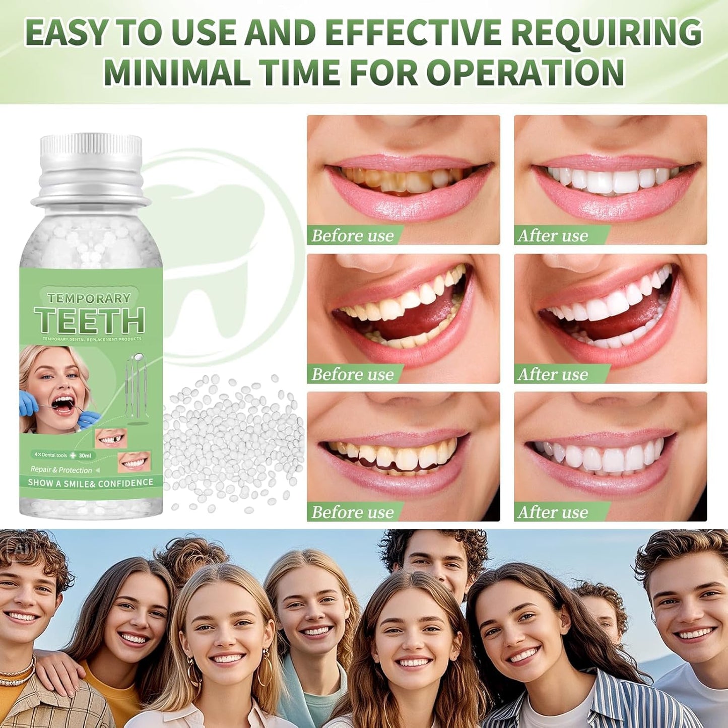 Tooth Repair Kit, Moldable Tooth Filling Repair Kit, Fake Teeth DIY at Home, Fixing Missing & Broken Tooth Replacements, with 4 Dental Tools-V04