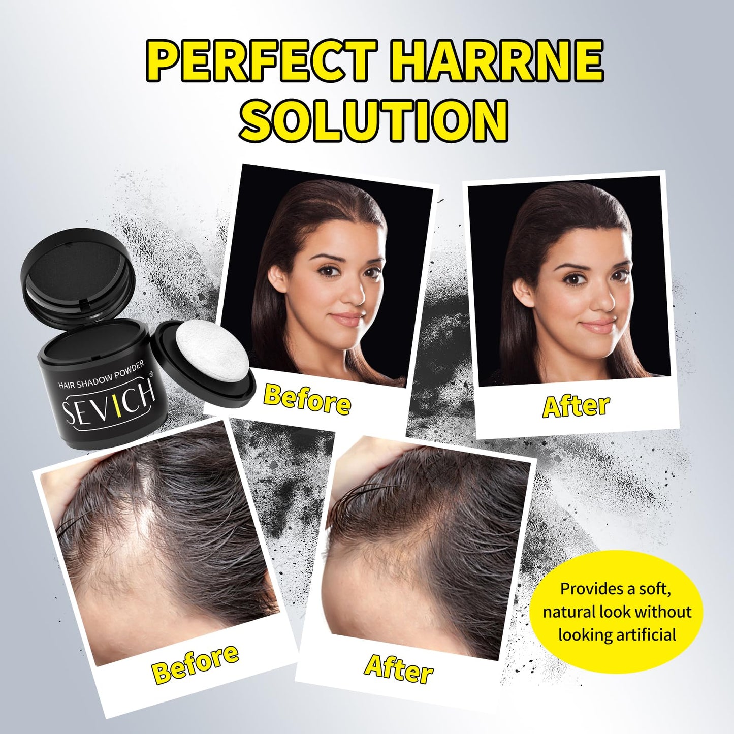 Sevich Hairline Powder 10g Large Capacity - Instantly Conceals Hair Loss, Root Touch up, Shadow Toppers for Women & Men Thinning Gray Hair - 48H Makeup Lasting, 1 Box = 2.5 Boxes, Dark Brown
