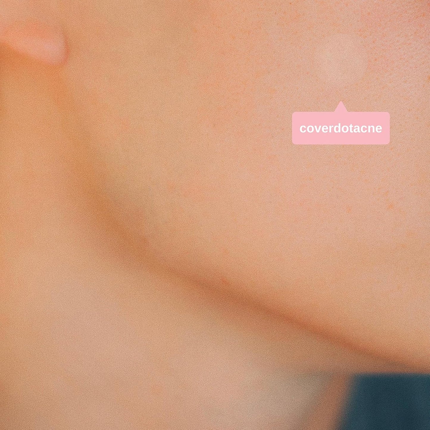 Hydrocolloid Acne Treatment Dots (120 Count) | Clear Waterproof Blemish Patches
