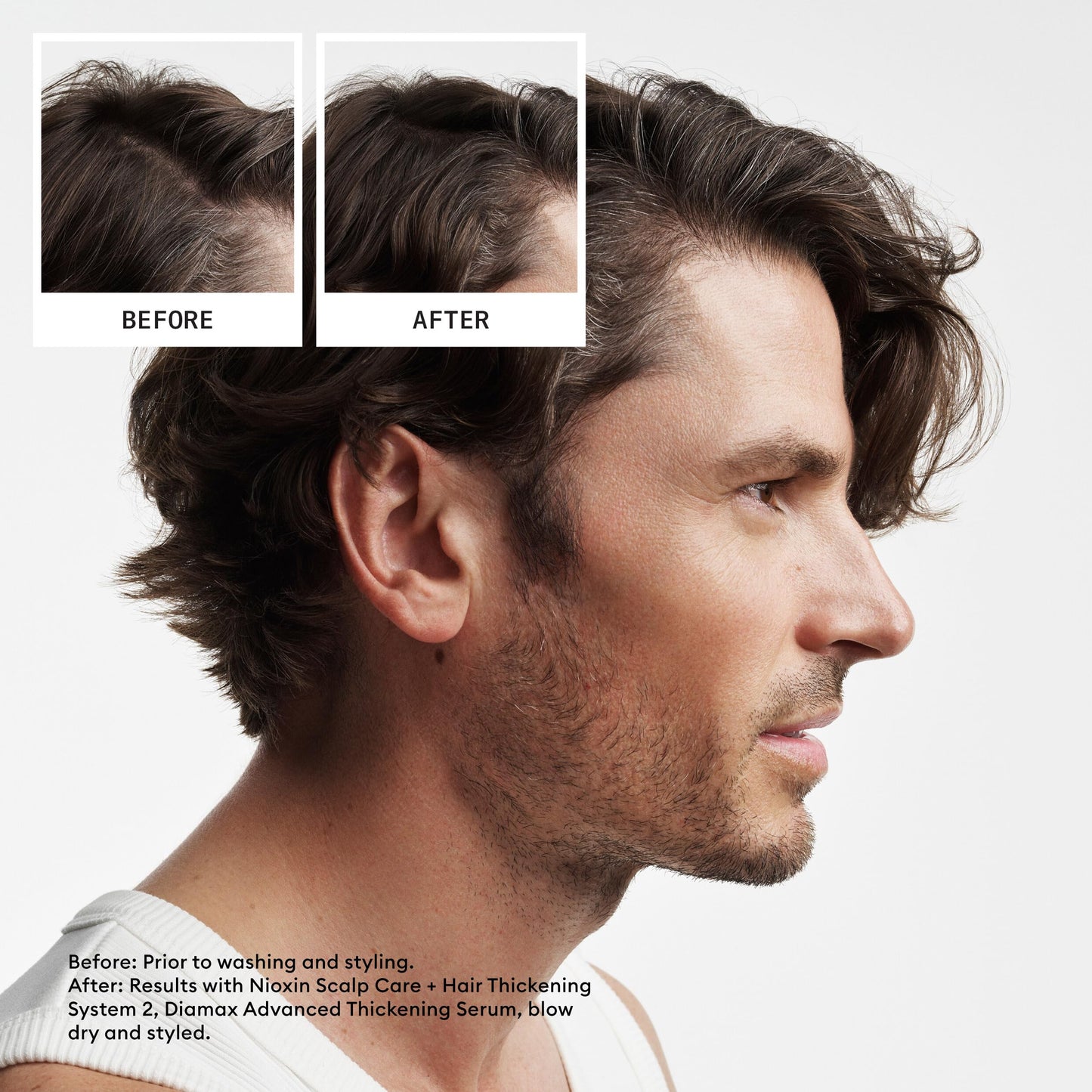 Nioxin Scalp + Hair Thickening System 2 Conditioner| For Natural or Untreated Hair with Progressed Thinning| With Niacinamide and Biotin | 33.8 Fl oz.