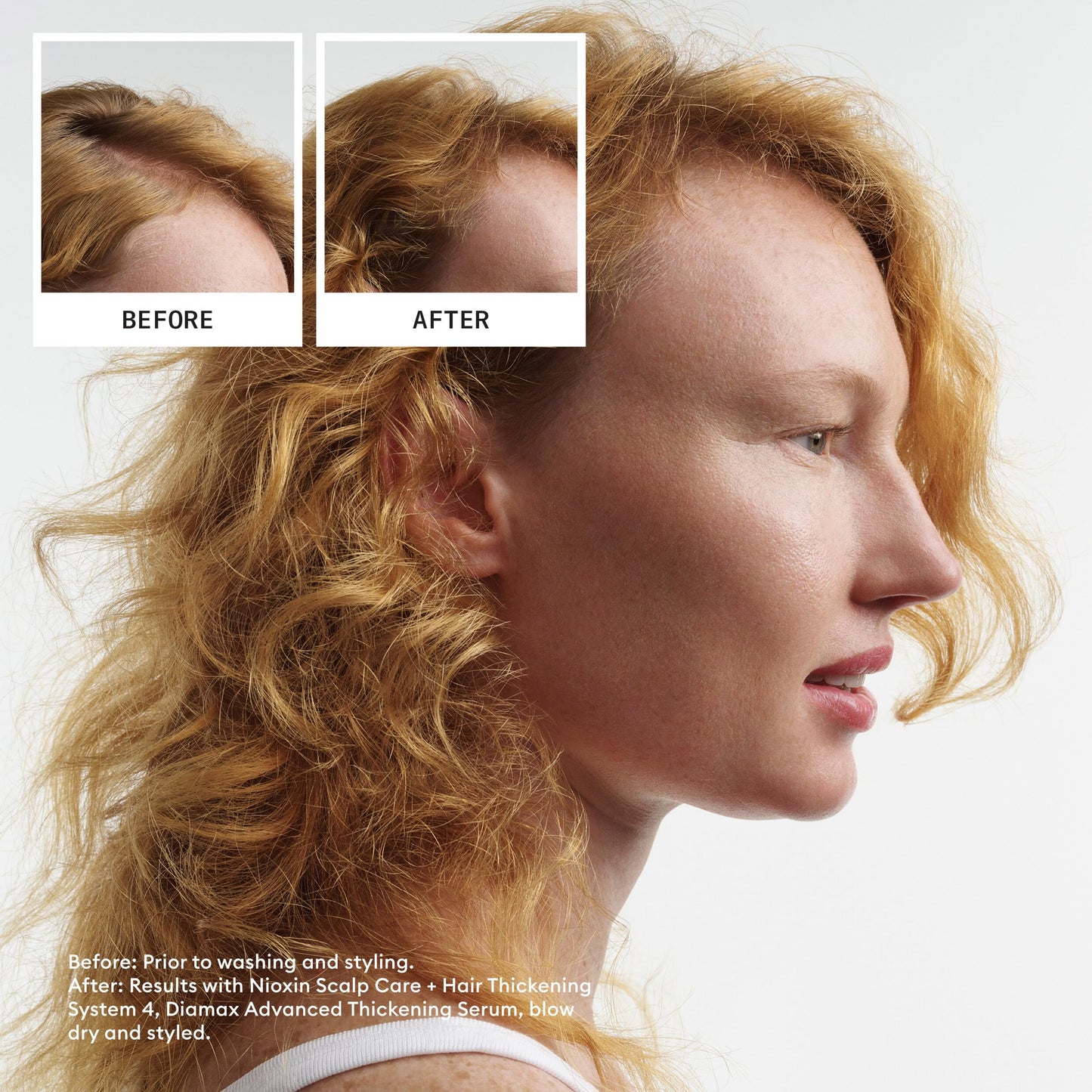 Nioxin System 4 Scalp + Hair Conditioner | For Colored or Damaged Hair with Progressed Thinning | With Niacinamide and Biotin | 33.8 Fl oz.