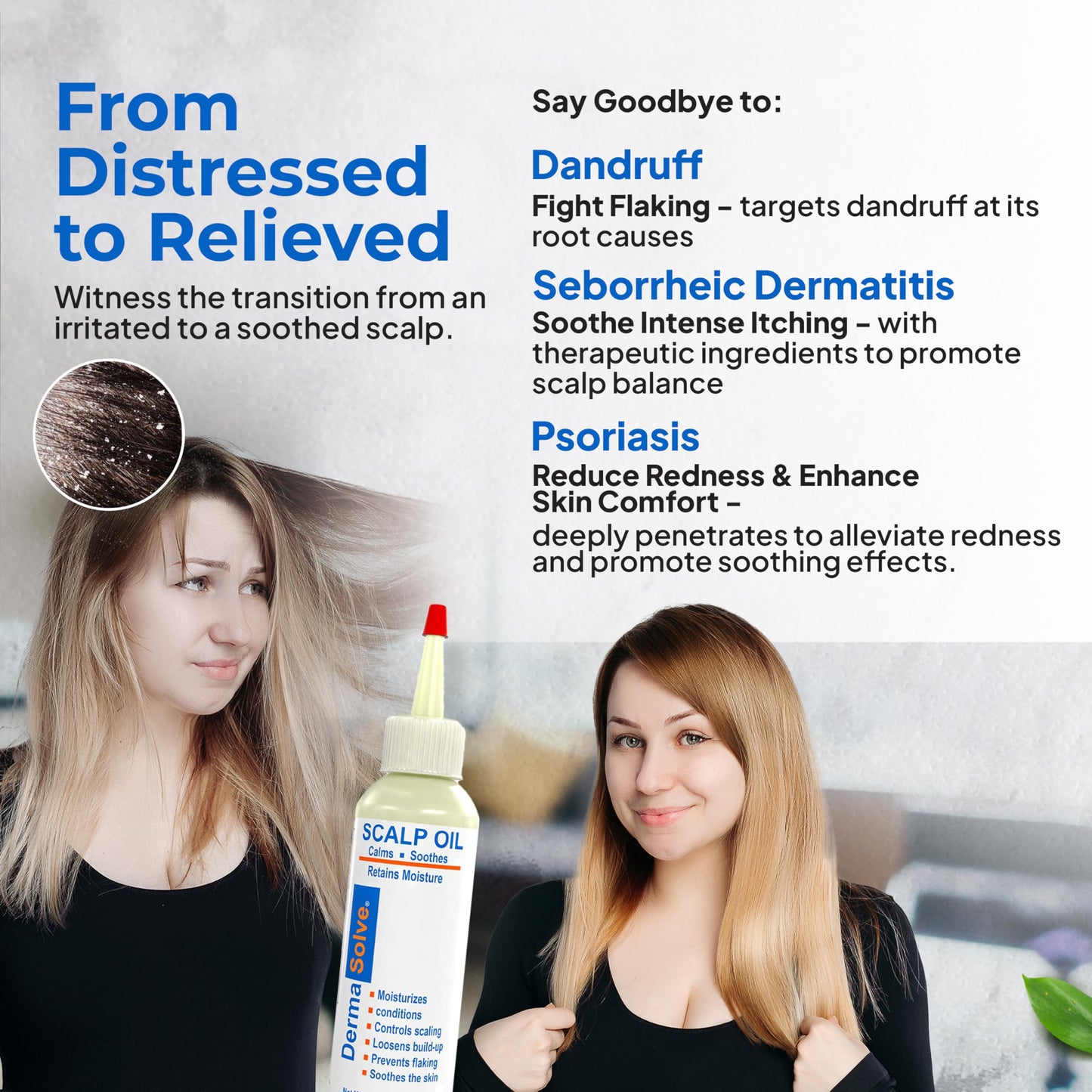 Dermasolve 4 oz Psoriasis, Seborrheic Dermatitis, & Dandruff Scalp Oil - Dermatologist Approved - Flaky Scalp Relief, Clinically Tested, Long-Lasting Itch-Free, High-Performance Formula