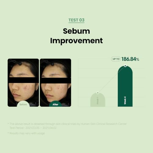 Soothing Skin Serum for Sensitive & Redness-Prone Skin - 50ml