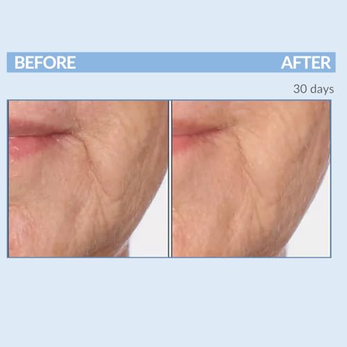 Serious Skincare Retinol Vitamin A Cream XR Premium Moisturizer for Face & Neck 2 fl oz, Anti-Aging - Day & Night - Reduce Fine Lines & Wrinkles - For Radiant Skin Set of 2