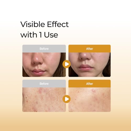 Centella Asiatica Serum 950,000ppm Cica Extract for Sensitive Skin - Fragrance-Free, Non-Greasy, 50ml