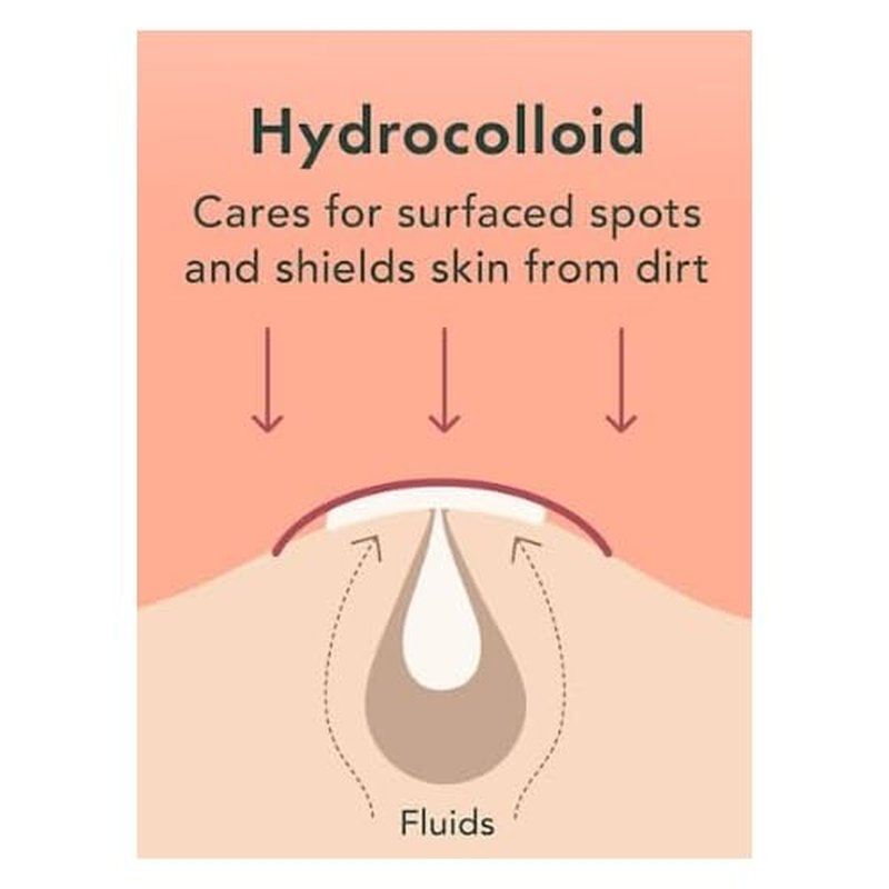Kool Patch, The Overnight Emergency Pimple Patch, 72 Hydrocolloid Patches.