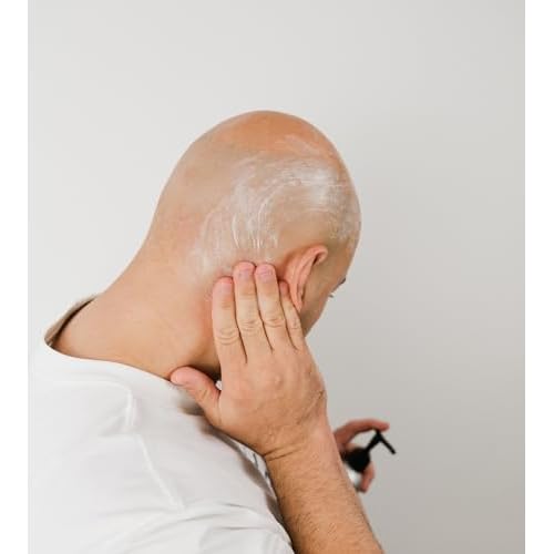 OnlyBalds Exfoliating Scalp & Face Cleanser ? 10 oz Aluminum Bottle ? Premium Daily Cleanser for Bald Men & Women, Shaved Heads, Alopecia Care & Shave Prep ? Fragrance-Free, Dermatologist Tested