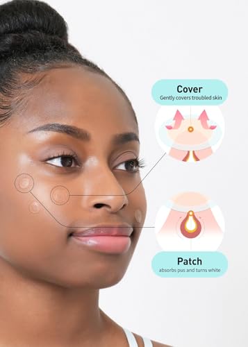 Hydrocolloid Acne Spot Patches - 102 Count, Strong Adhesion, Cover Zits & Blemishes, Trouble Skin Care, Pack of 5