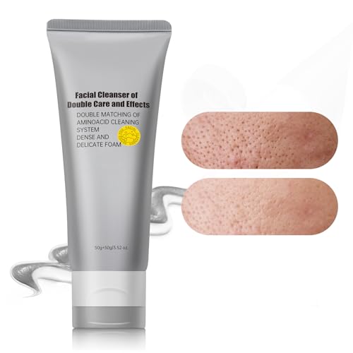 Turmeric Lotion for Spots - Natural Turmeric Skin Brightening Cream for Face & Body - Cleanse Skin, Fight Acne, Even Tone, Clear Scars, Sun Damage, & Discoloration - with Vitamin C