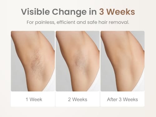 FELOOW IPL Hair Removal Device for Women - Permanent Laser System, 3 Weeks Results