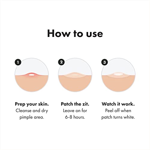 Acne Patches Bundle - Clear Skin Overnight, Large & Small Spots