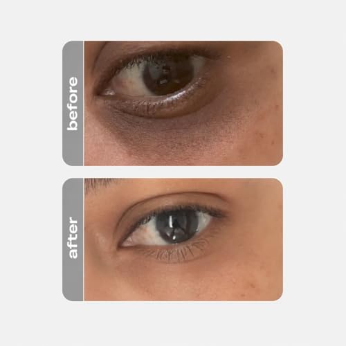 Hydrating Eye Cream for Brightening & Anti-Aging - Dark Circles & Puffiness