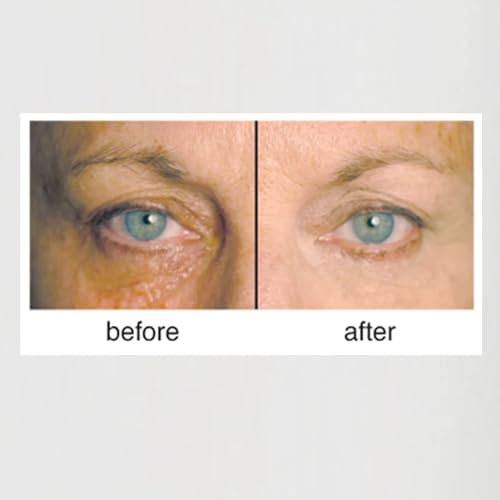 Clientele Peptide Wrinkle Concealer Compact Neutral