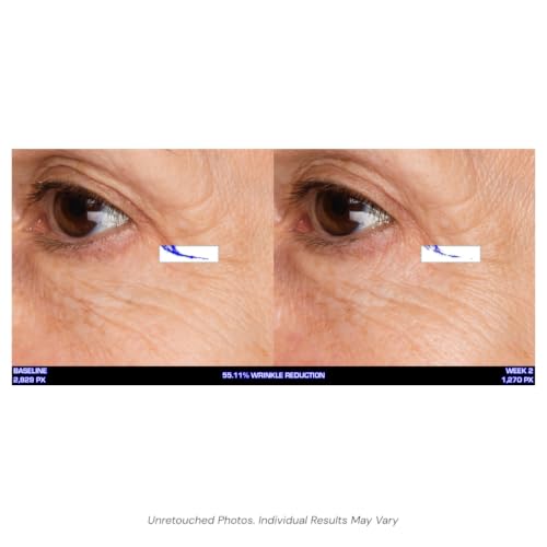 Revitalizing Eye Cream with Peptides & Collagen Support - 0.5 oz