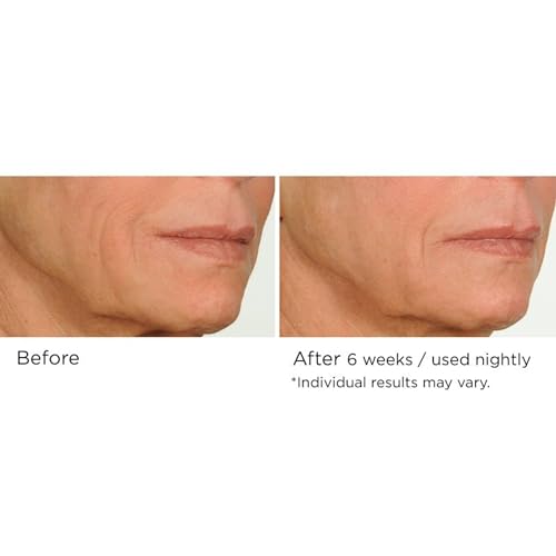 NassifMD Night Therapy Serum