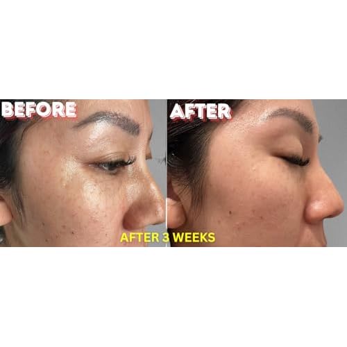 4XPeptide Plus Serum Collagen Boosting Anti-Aging Esthetician Collagen Boost for Face, Skin Facial Smooth Wrinkles and Fine Lines Skincare