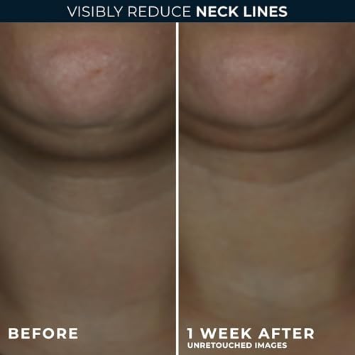 Retinol Hyaluronic Acid Neck Firming Cream - Anti-Aging Moisturizer 1.7 oz
