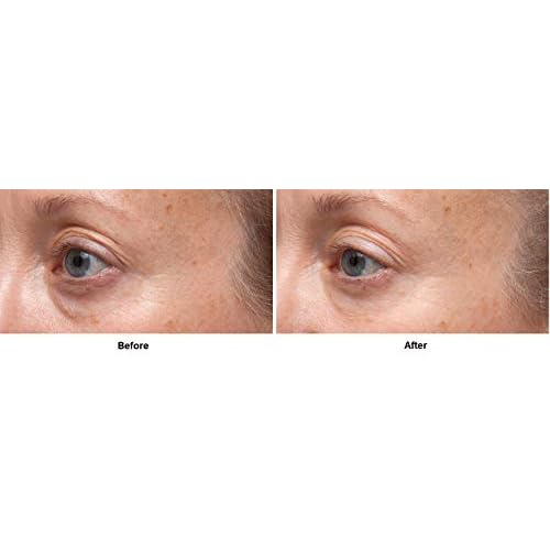 Dr Dennis Gross Ferulic + Retinol Triple Correction Eye Serum: for Wrinkles, Loss of Elasticity, and Rough Texture, 0.5 fl oz
