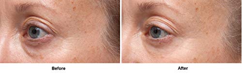 Eye Serum for Wrinkles & Skin Firming - Ferulic + Retinol, 0.5 fl oz