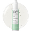 Back and Body Acne Treatment Spray: 2% Salicylic Acid & Tea Tree Oil Bacne Spray for Clear, Soothe & Moisturize - Effective for Men, Women, Teens with Back, Shoulder, Arm, and Chest Acne