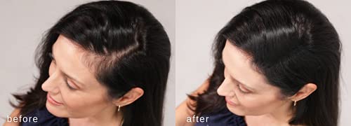 Hair Building Fibers for Thinning Hair - Natural Thickening - Dark Brown - 2 Months+ Supply