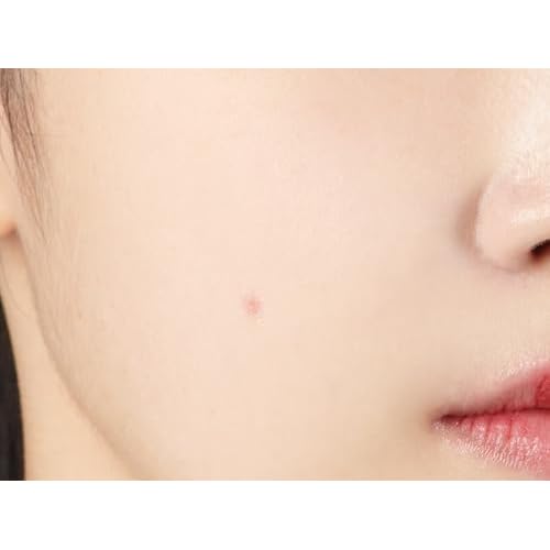 JMsolution Heartleaf Acne Pimple Patch - Hydrocolloid Slim Fit Acne Patches with Heartleaf, Tea Tree Oil, Centella Extract - 2 Size S (6 dots), M (5 dots) for Fast Healing and Protection