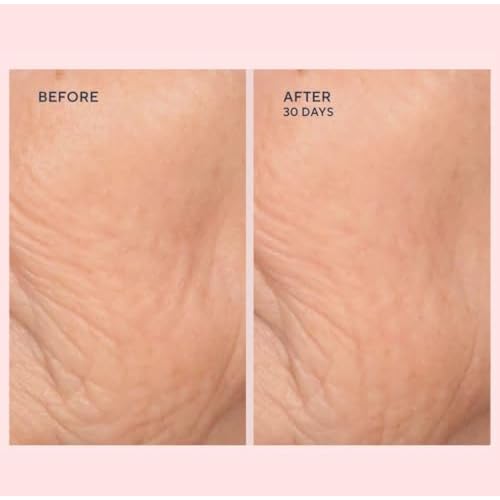 Serious Skincare - C-Extreme Results Facial Exfoliator - Deep Pore Cleansing & Resurfacing Skin Treatment - Vitamin C, Collagen & Natural Fruit Enzymes - For Smoother Radiant Face & Neck - 2 fl. oz