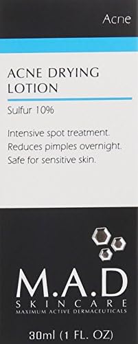 Acne Spot Treatment - 10% Sulfur & Salicylic Acid, Drying Lotion, 1 Fl Oz - Pack of 1