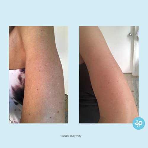 Perfect Image Hydro-Glo Peel Pads 10% Strength with Kojic & Natural Extracts