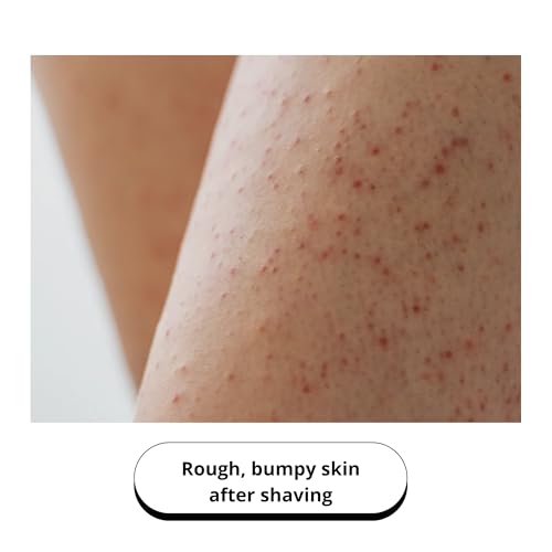 Deep Exfoliating Mitt Body Scrub - Exfoliating Glove Body Scrubber & Skin Cleanser - Body Scrub Gloves for Women & Men - Skin Exfoliator for Body Tool Remover of Dead & Dry Skin