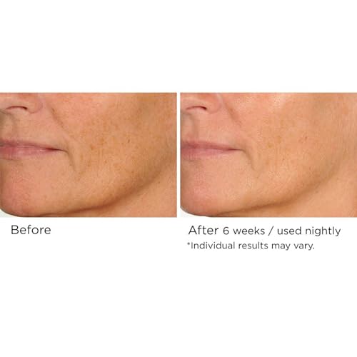 NassifMD Night Therapy Serum