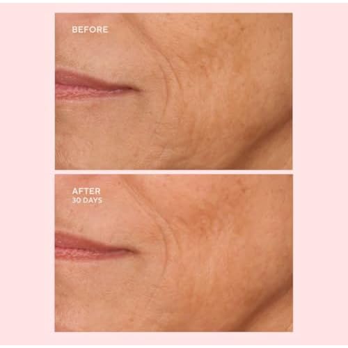 Serious Skincare - C-Extreme Results Facial Exfoliator - Deep Pore Cleansing & Resurfacing Skin Treatment - Vitamin C, Collagen & Natural Fruit Enzymes - For Smoother Radiant Face & Neck - 2 fl. oz