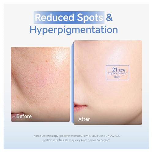 DAERA Synergy Boost Ampoule ? Korean Brightening & Hydrating Face Serum, Dark Spot Correcting & Anti-Aging Ampoule with Calcium Up+ Complex, Firming Serum for Glowing Skin, 30ml