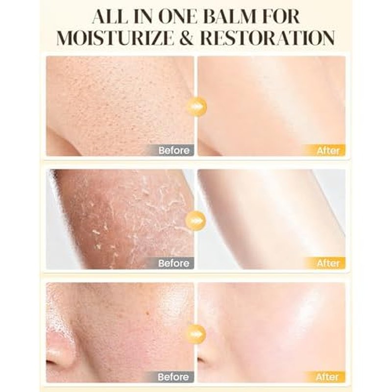 Bee Venom Moisturizing Cream, All-in-One Nourishing Moisturizer with Hyaluronic Acid, Firming & Hydrating Face and Body Cream, Natural Gentle Formula for All Skin Types (50g * 2PCS)