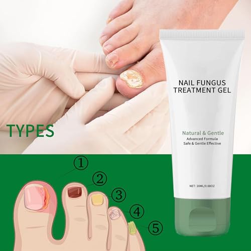 Exfoliating Foot Peel Mask with AHA/BHA & 4 Fruit Extracts ? Removes Dead Skin & Calluses for Baby Soft Feet ? Foot Peeling Mask Socks for Dry, Cracked Feet (4 Pairs)