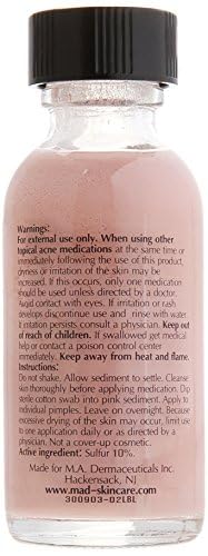 Acne Spot Treatment - 10% Sulfur & Salicylic Acid, Drying Lotion, 1 Fl Oz - Pack of 1