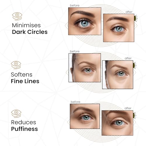 REVITALE 24k Gold Under Eye Collagen Patches, Reduce Puffy Eyes & Dark Circles, Illuminate Tired Eye Masks - Firms, Brightens, Energises (Packets - 10 Pair)