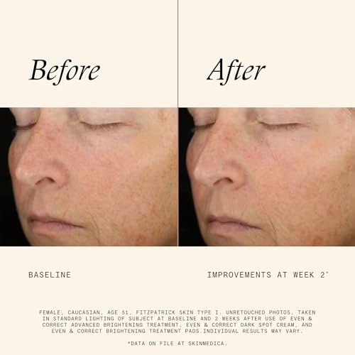 Brightening Facial Treatment Pads with 10% Glycolic Acid - Hydroquinone-Free, Alcohol-Free, Retinol-Free, 60 Count