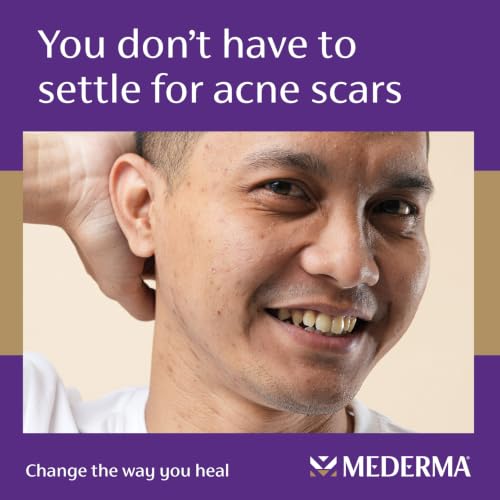 Mederma Acne Scar Serum - Visibly Lighten & Smooth Post-Acne Marks, 1 Fl Oz