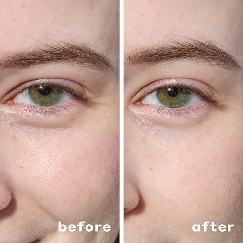 Green Hydrating Under Eye Masks for Dark Circles & Puffiness - 30 Count - Hydrogel Eye Patches
