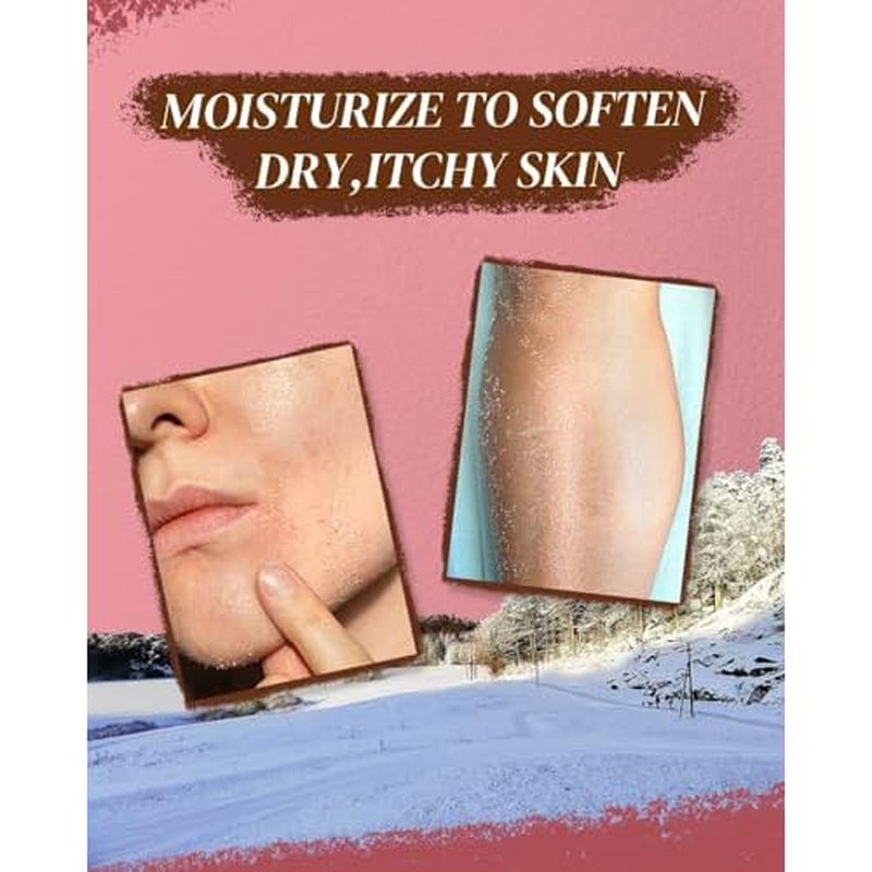 Australian Lanolin Cream,Natural Lanolin Cream for Itchy Dry Skin,Organic Lanolin Oil Moisturizer for Body and Face,3.53 fl oz