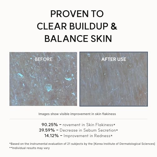 Glycolic Acid Exfoliating Face Serum for Pore Refinement & Skin Texture - 30mL