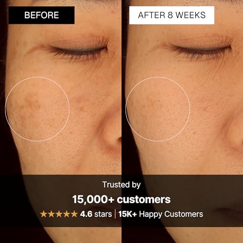 The Korean Dark Spot Solution Kit, 3 Step Skincare For Mature Skin, Hydrates, Target Dark Spots and Wrinkles. Serum, Face Cream and Mask, Made in Korea (Full Size Kit)